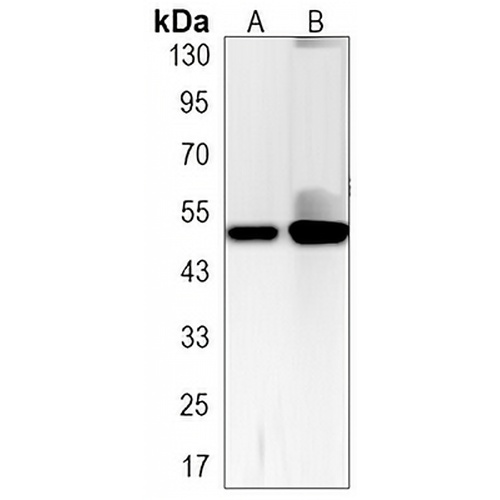 p53 (Phospho-S6) Rabbit Monoclonal Antibody(C3225)