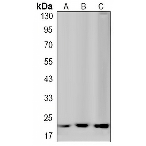 ATF3 Rabbit Monoclonal Antibody(C3227)
