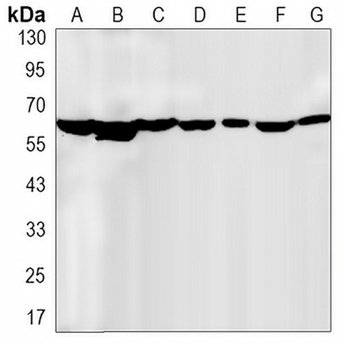 CCT2 Rabbit Monoclonal Antibody(C3231)