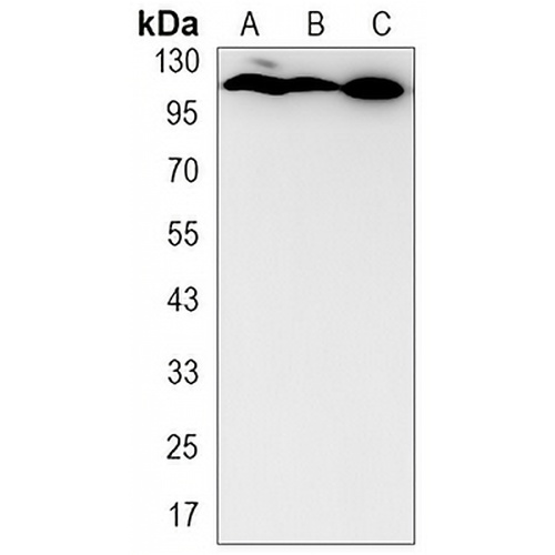 CLSTN1 Rabbit Monoclonal Antibody(C3232)