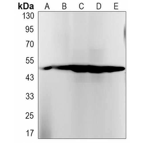 Cytochrome P450 2D6 Rabbit Monoclonal Antibody(C3235)