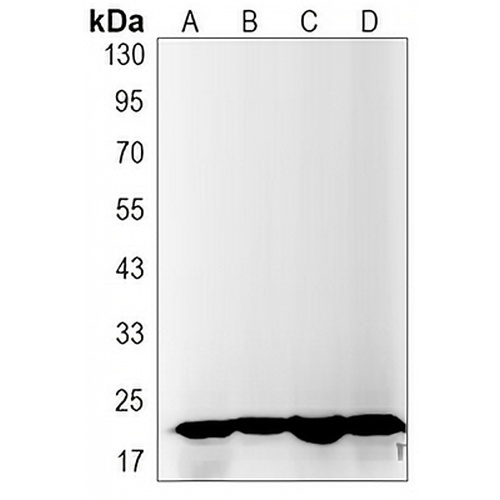 IL-26 Rabbit Monoclonal Antibody(C3244)