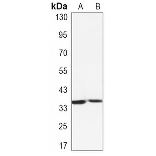 L1RE1 Rabbit Monoclonal Antibody(C3248)