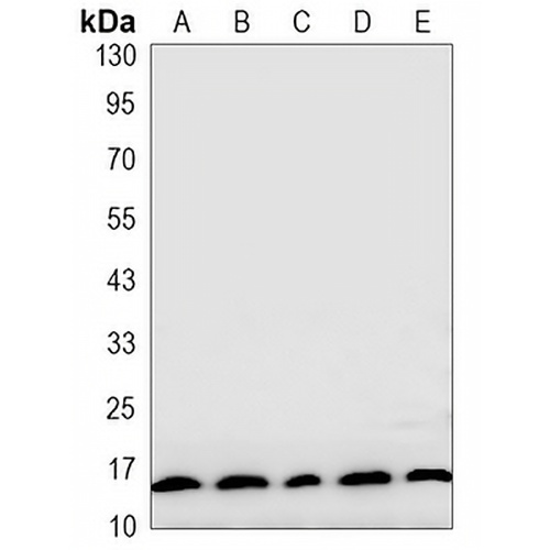 LC3-I/II Rabbit Monoclonal Antibody(C3249)
