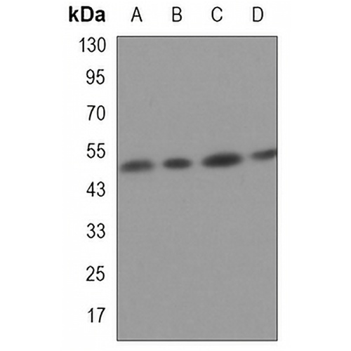 P2Y12 Rabbit Monoclonal Antibody(C3251)