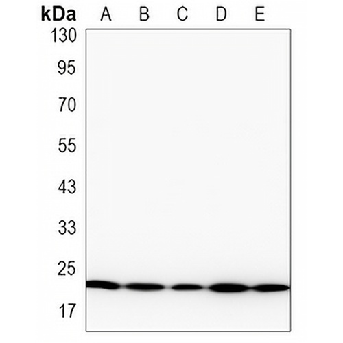 NRAS Rabbit Monoclonal Antibody(C3256)