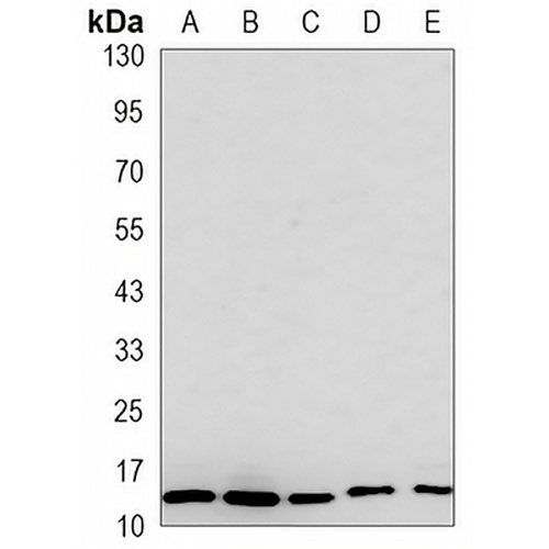 RPS20 Rabbit Monoclonal Antibody(C3257)