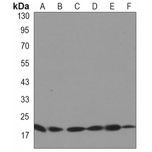 UBC9 Rabbit Monoclonal Antibody(C3265)