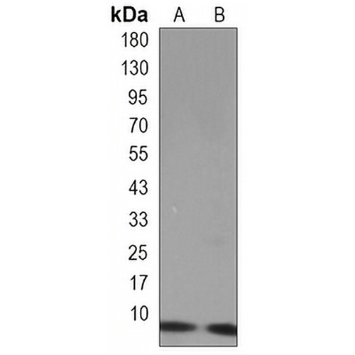 UBB Rabbit Monoclonal Antibody(C3266)
