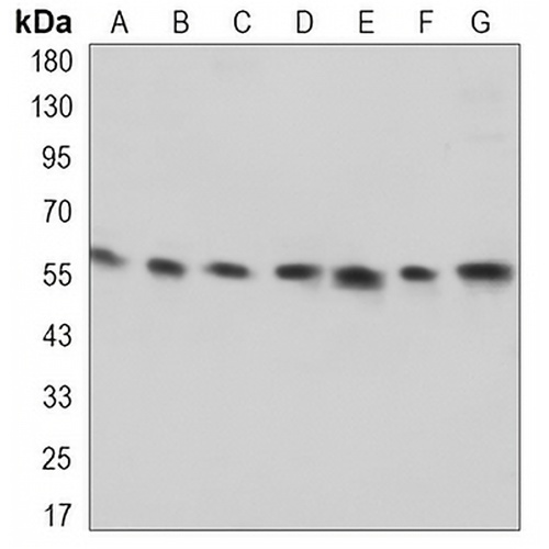 Visfatin Rabbit Monoclonal Antibody(C3267)