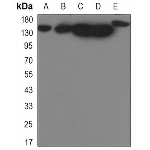 YTHDC2 Rabbit Monoclonal Antibody(C3268)