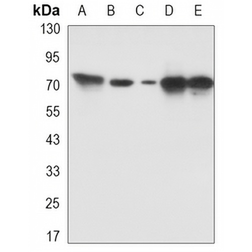 PKC beta Rabbit Monoclonal Antibody(C3270)