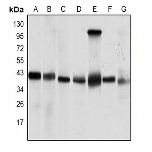 PP2C-alpha Mouse Monoclonal Antibody(C3271)