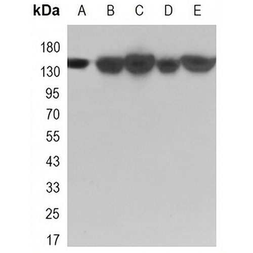 KDM4A Rabbit Monoclonal Antibody(C3272)
