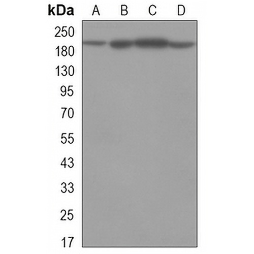 KDM5C Mouse Monoclonal Antibody(C3273)