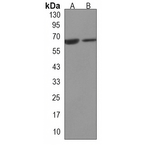 JMJD6 Mouse Monoclonal Antibody(C3276)