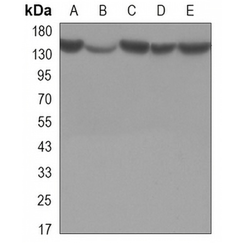 Histone Deacetylase 4 Mouse Monoclonal Antibody(C3281)
