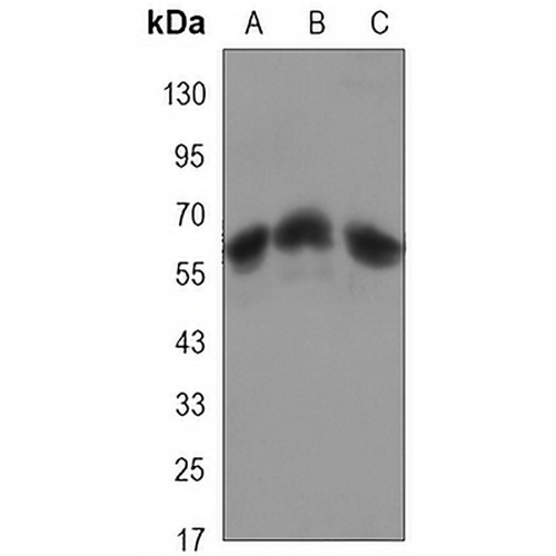 CARM1 Mouse Monoclonal Antibody(C3282)