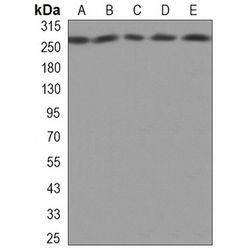 FASN Mouse Monoclonal Antibody(C3288)