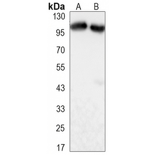 TIF1 beta Mouse Monoclonal Antibody(C3294)