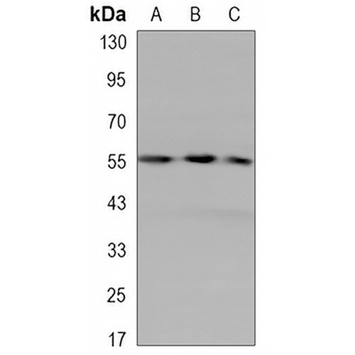 Cytokeratin 7 Mouse Monoclonal Antibody(C3296)