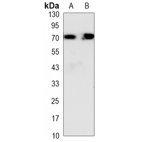 HSP70 Mouse Monoclonal Antibody(C3299)