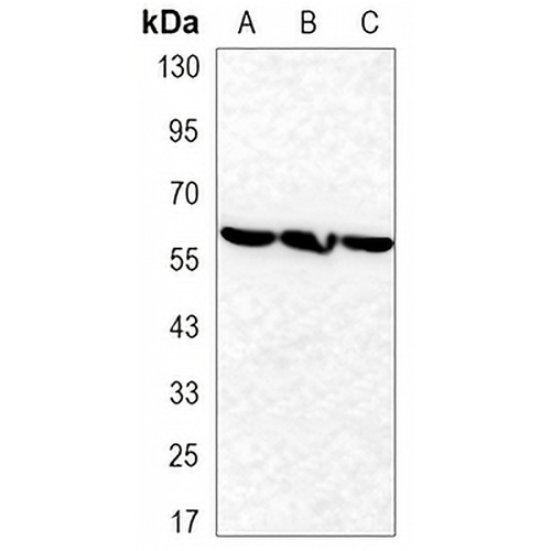 TBL1XR1 Mouse Monoclonal Antibody(C3301)