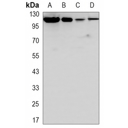 ACLY Mouse Monoclonal Antibody(C3304)