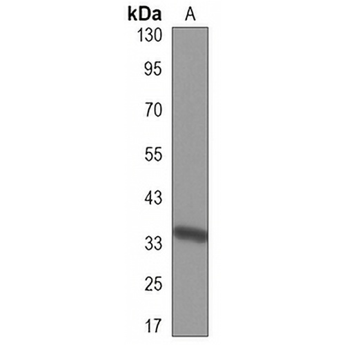 Cyclin D2 Mouse Monoclonal Antibody(C3312)