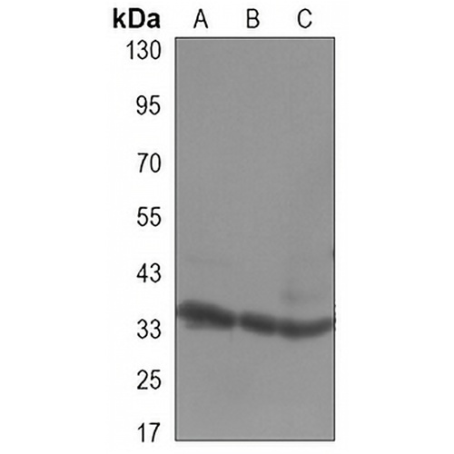 CDK4 Mouse Monoclonal Antibody(C3316)