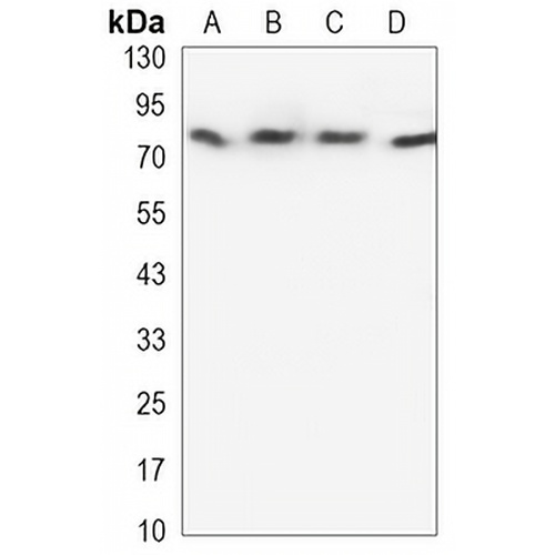 BTK Mouse Monoclonal Antibody(C3320)