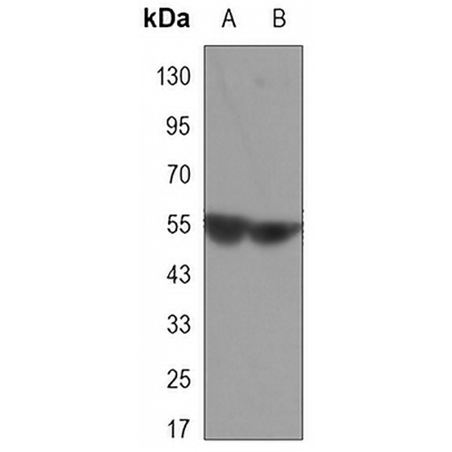 CaMK4 Mouse Monoclonal Antibody(C3322)
