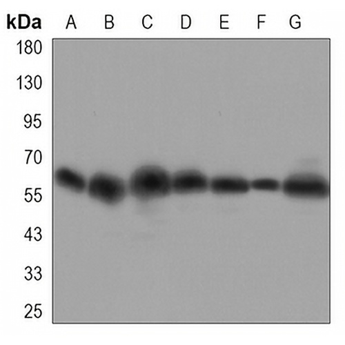 FYN Mouse Monoclonal Antibody(C3327)