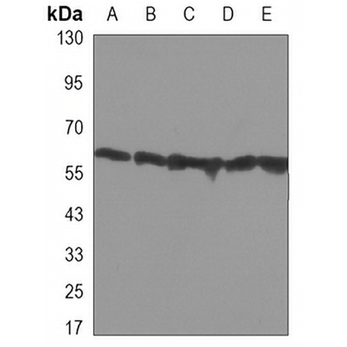 Pyruvate Kinase Mouse Monoclonal Antibody(C3335)