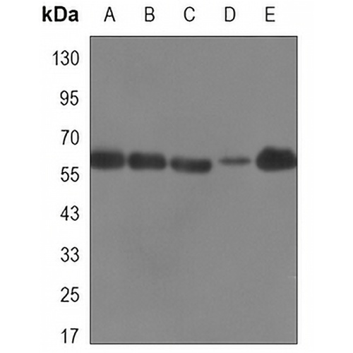 ATIC Mouse Monoclonal Antibody(C3336)