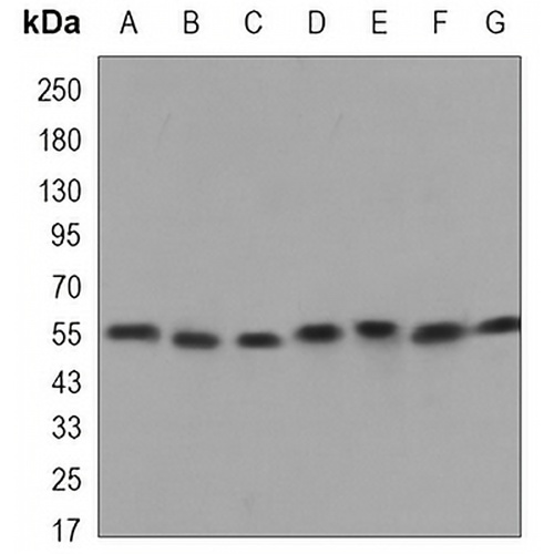 Beclin-1 Mouse Monoclonal Antibody(C3338)