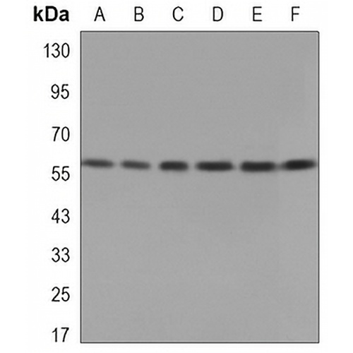 PDC-E2 Mouse Monoclonal Antibody(C3340)