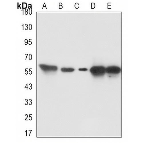 TXNRD2 Mouse Monoclonal Antibody(C3341)