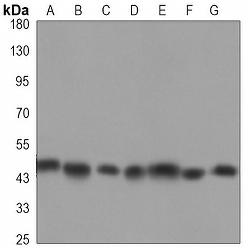 Histone Deacetylase 3 Mouse Monoclonal Antibody(C3343)