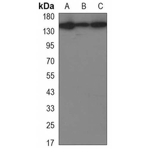 BAF155 Mouse Monoclonal Antibody(C3344)