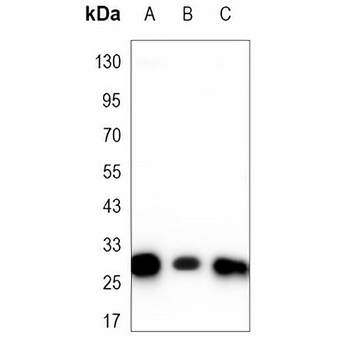 CBR1 Mouse Monoclonal Antibody(C3348)