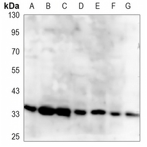 CDX2 Mouse Monoclonal Antibody(C3351)