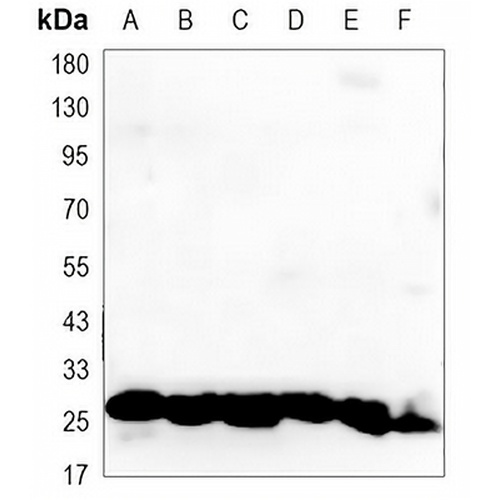HSP27 Mouse Monoclonal Antibody(C3352)