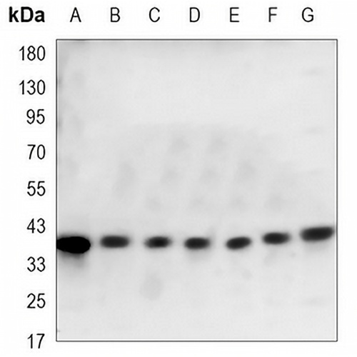 p38 Mouse Monoclonal Antibody(C3353)