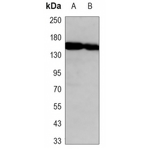 Histone Deacetylase 6 Mouse Monoclonal Antibody(C3358)
