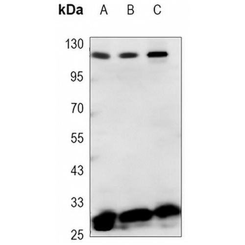 Phostensin Mouse Monoclonal Antibody(C3360)