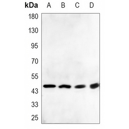 DR5 Mouse Monoclonal Antibody(C3361)