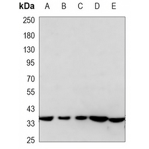 AMPK beta 1 Mouse Monoclonal Antibody(C3362)