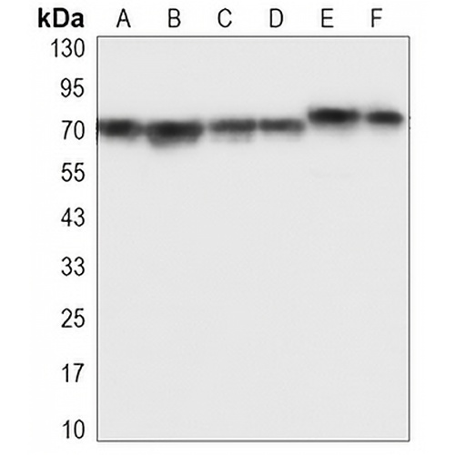 IGF2BP3 Mouse Monoclonal Antibody(C3365)