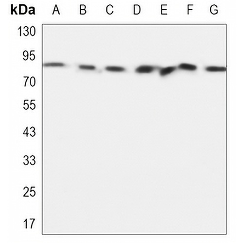 PI3K p85 beta Mouse Monoclonal Antibody(C3367)